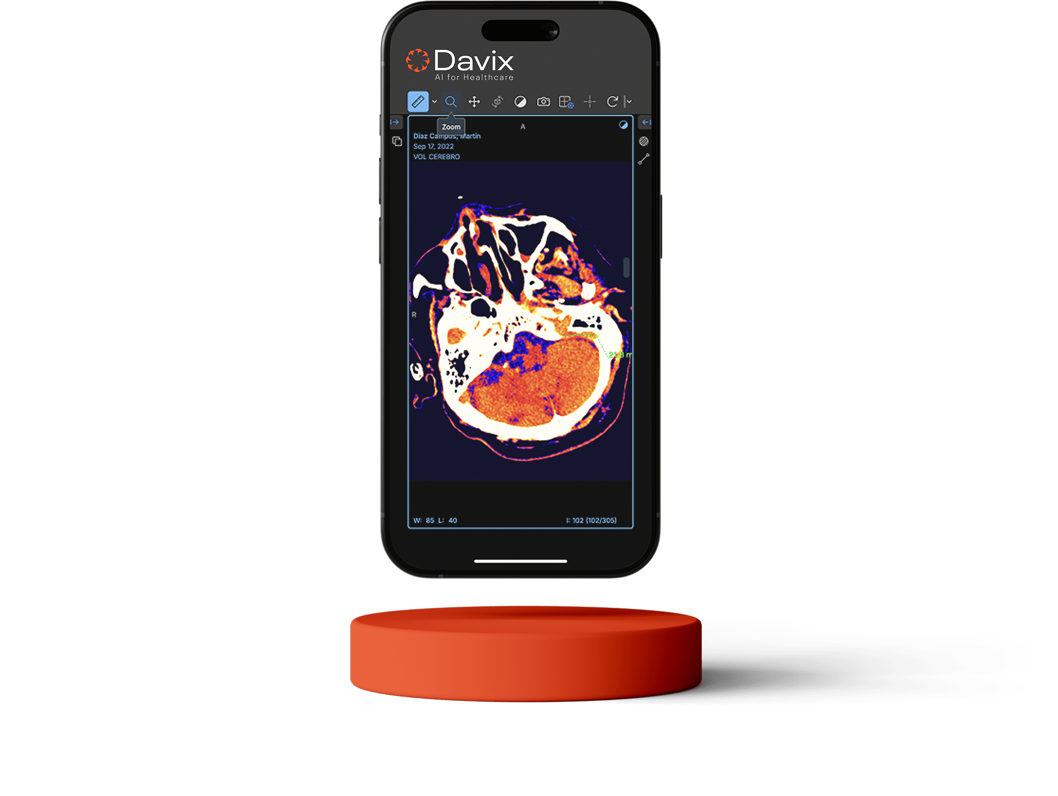 Davix Mobile App