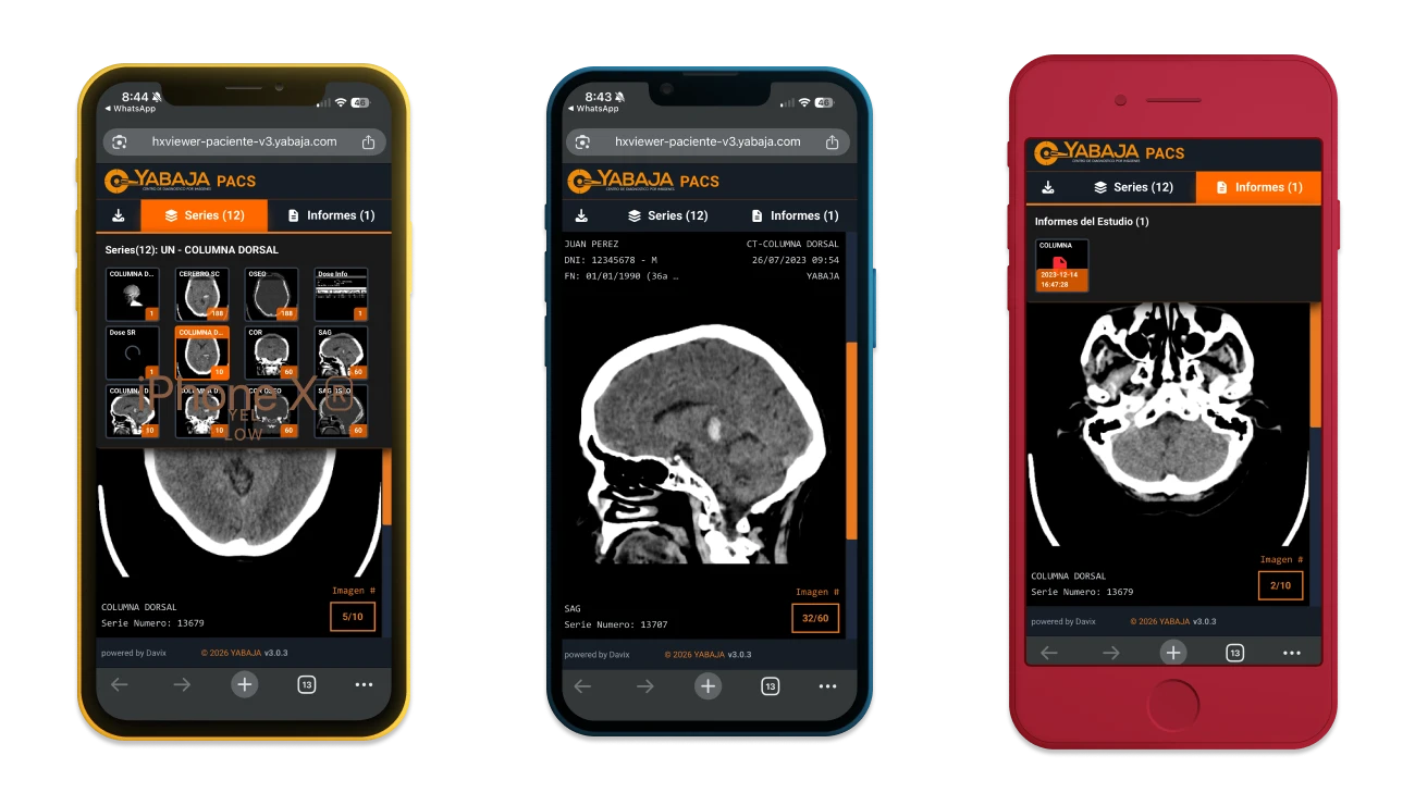 Portal del Paciente Davix PACS