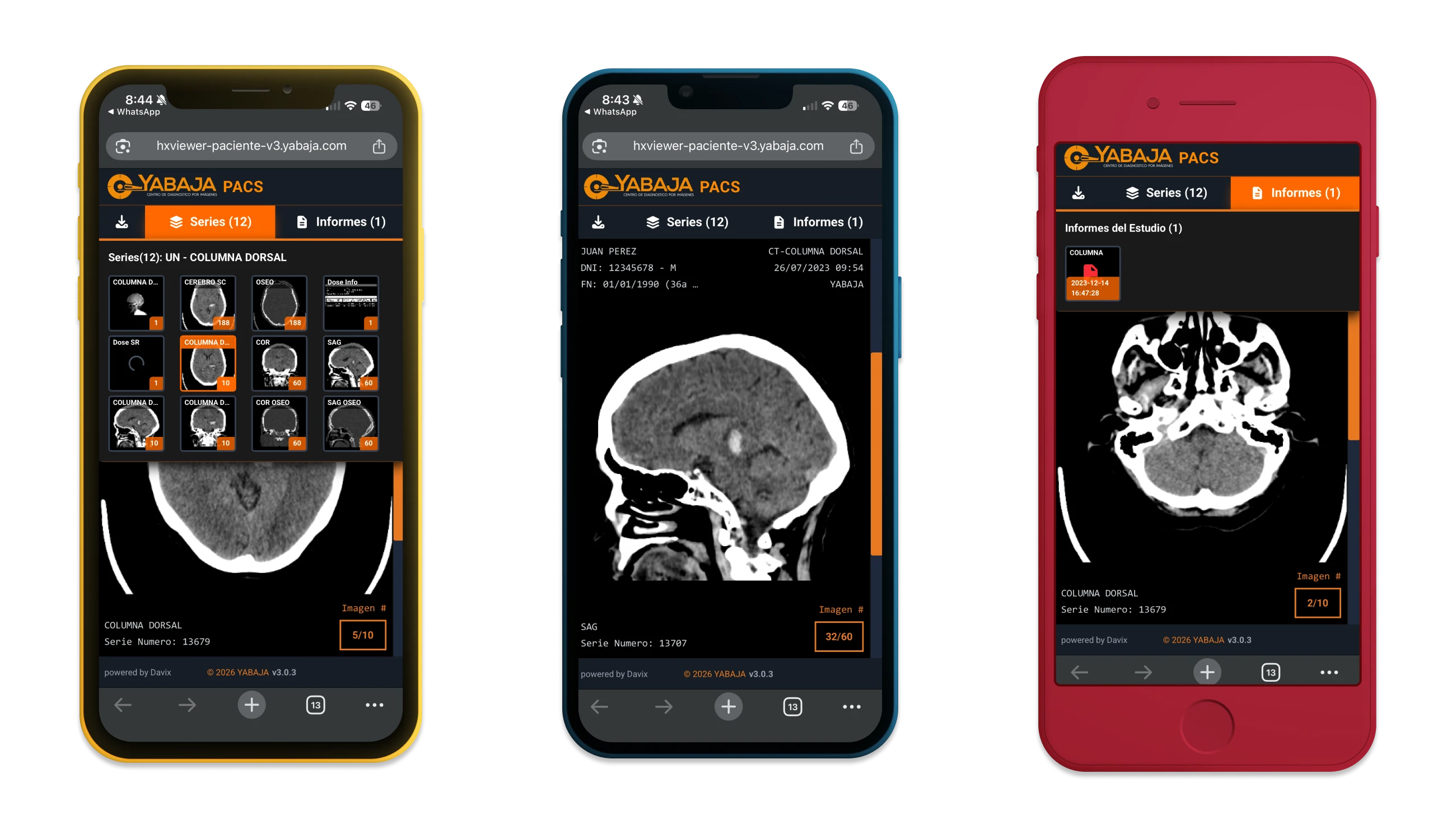 Davix PACS Visor Paciente