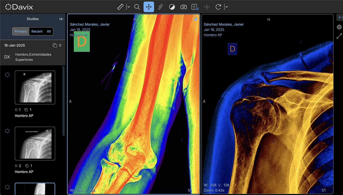 Visor DICOM integrado
